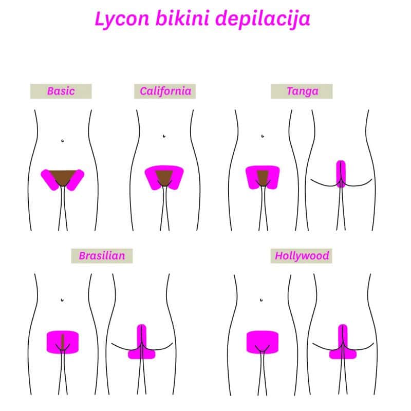 brazilska depilacija lycon
